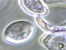 緊急企画！ 花粉観察～花粉を位相差顕微鏡で見る～